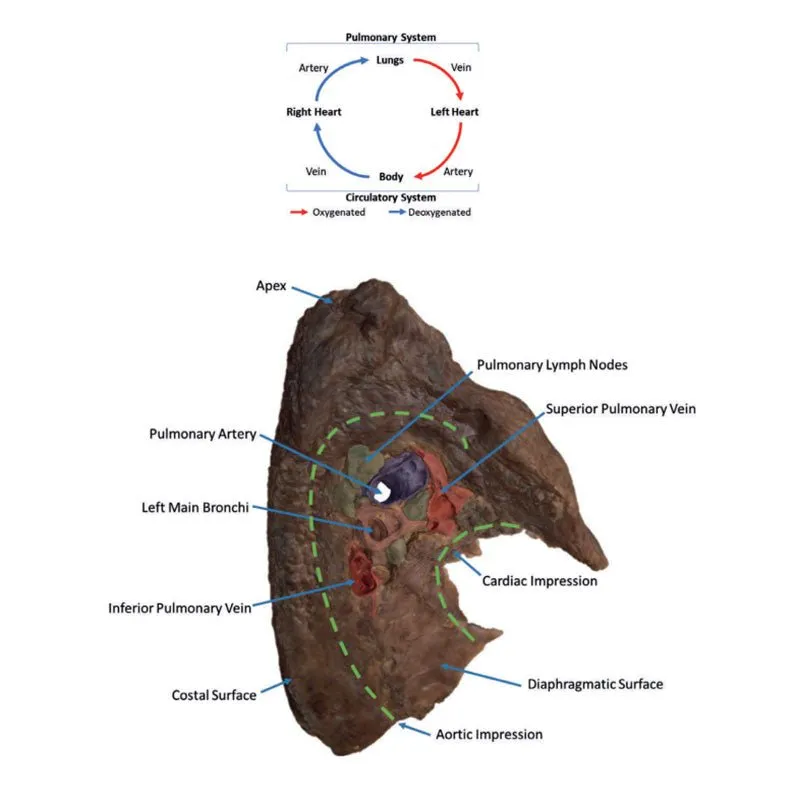 3D Printed Hilum of the Left Lung