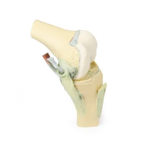 3D Printed Knee Joint Model