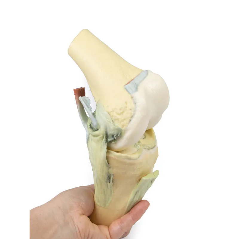 3D Printed Knee Joint Model