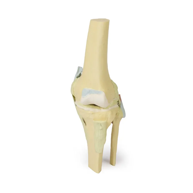 3D Printed Knee Joint Model