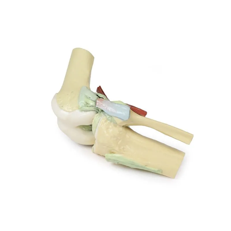 3D Printed Knee Joint Model