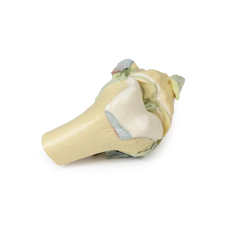 3D Printed Knee Joint Model