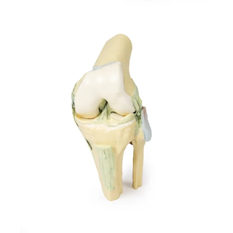 3D Printed Knee Joint Model