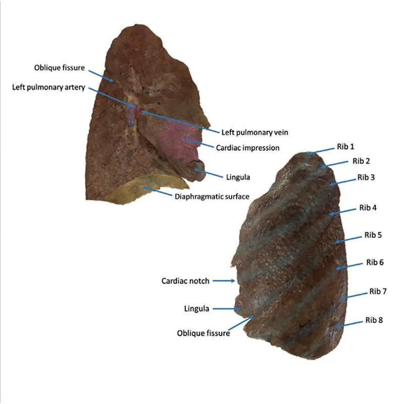 3D Printed Lung Slab, Hilum Removed